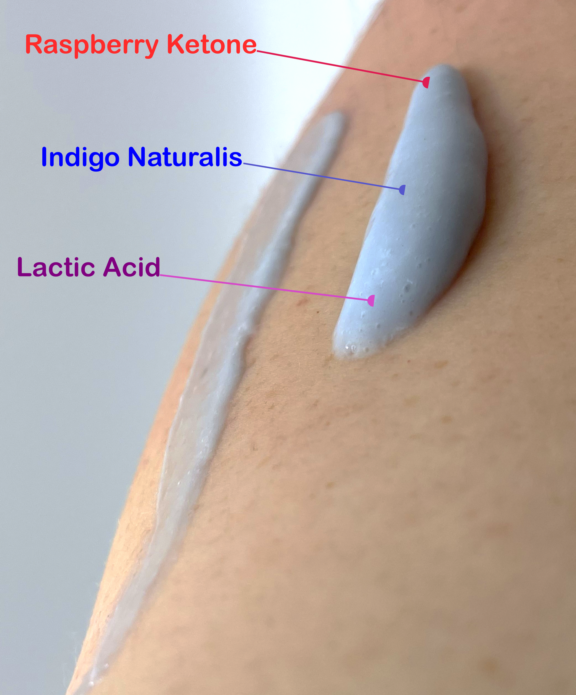 KP skincare lotion for Keratosis Pilaris treatment & repair